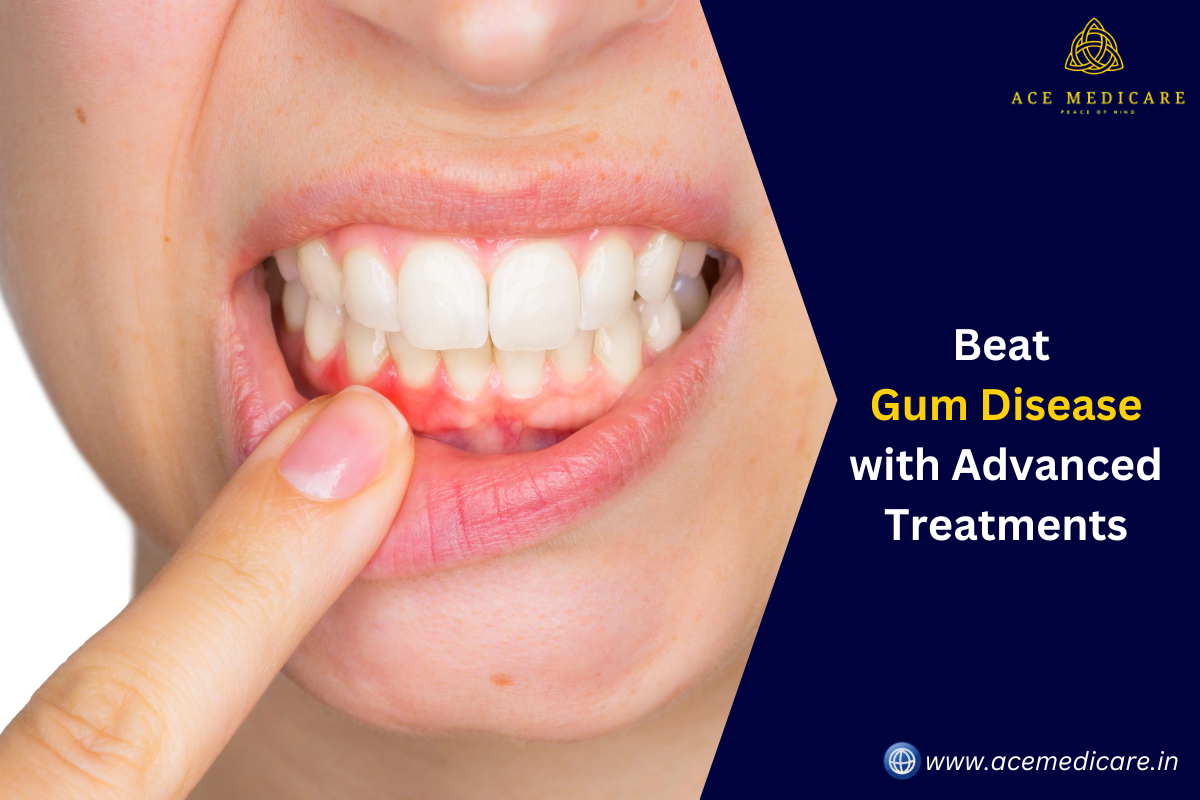 Beat Gum Disease with Advanced Treatments